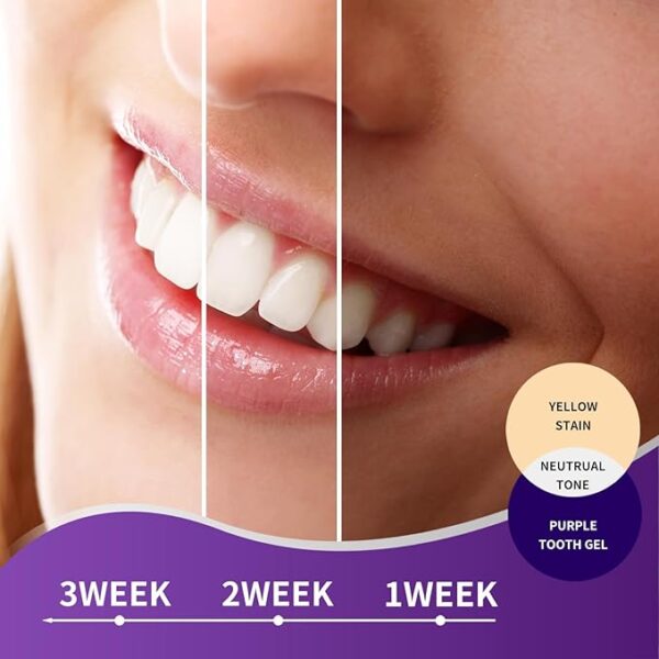 -10%   MySmile Purple Toothpaste for Tooth Brighte - Image 2