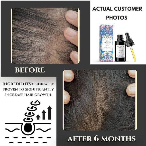 USDA Organic Rosemary Hair Growth Treatment with Castor - Image 4